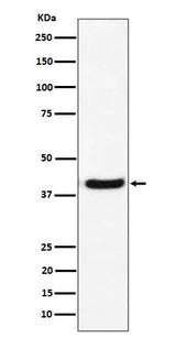 Anti-GNAI2 Rabbit Monoclonal Antibody Boster Bio