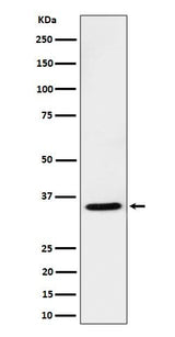 Anti-USF1 Rabbit Monoclonal Antibody Boster Bio
