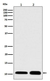 Anti-S100 S100A1 Rabbit Monoclonal Antibody Boster Bio