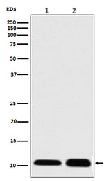 Anti-S100 S100A1 Rabbit Monoclonal Antibody Boster Bio