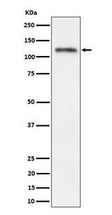 Anti-Semaphorin 4D / CD100 Rabbit Monoclonal Antibody Boster Bio