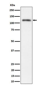 Anti-Semaphorin 4D / CD100 Rabbit Monoclonal Antibody Boster Bio