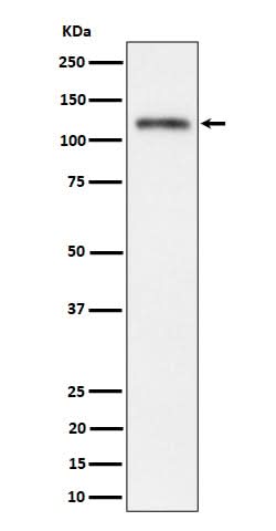 Anti-Semaphorin 4D / CD100 Rabbit Monoclonal Antibody Boster Bio