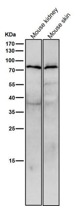 Anti-STK39 Rabbit Monoclonal Antibody Boster Bio
