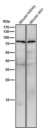 Anti-STK39 Rabbit Monoclonal Antibody Boster Bio