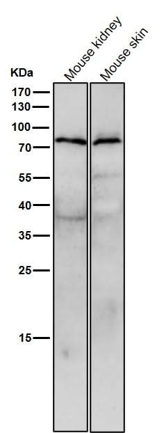 Anti-STK39 Rabbit Monoclonal Antibody Boster Bio