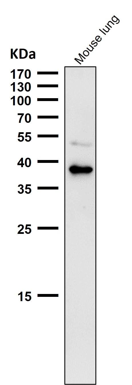 Anti-CXCR6 / CD186 Rabbit Monoclonal Antibody Boster Bio