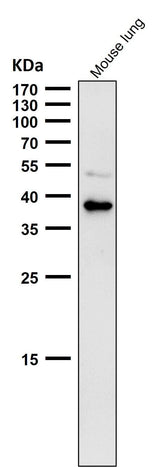 Anti-CXCR6 / CD186 Rabbit Monoclonal Antibody Boster Bio