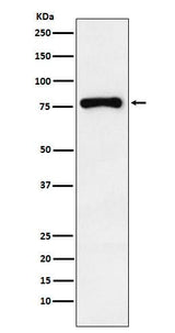 Anti-RNase L Rabbit Monoclonal Antibody Boster Bio
