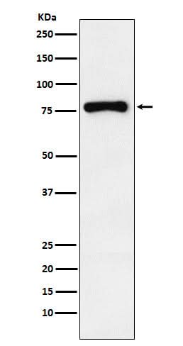 Anti-RNase L Rabbit Monoclonal Antibody Boster Bio