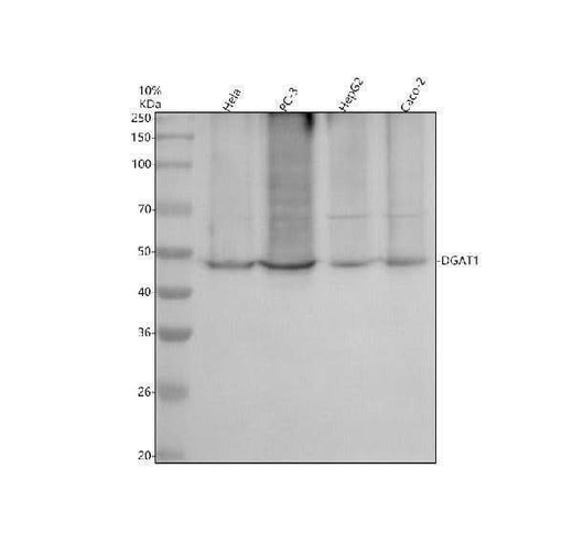 Anti-DGAT1 Rabbit Monoclonal Antibody Boster Bio