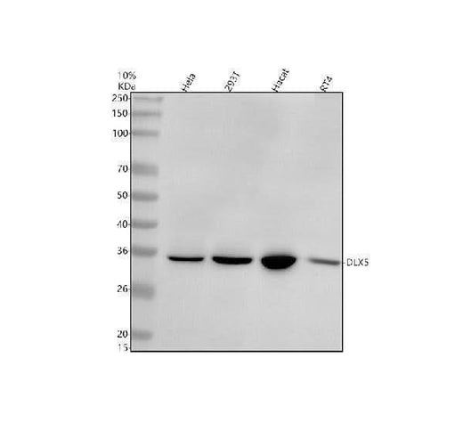 Anti-Dlx5 Rabbit Monoclonal Antibody Boster Bio