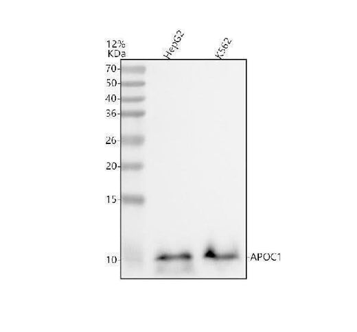 Anti-Apolipoprotein CI Rabbit Monoclonal Antibody Boster Bio