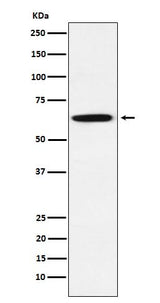 Anti-GRB7 Rabbit Monoclonal Antibody Boster Bio