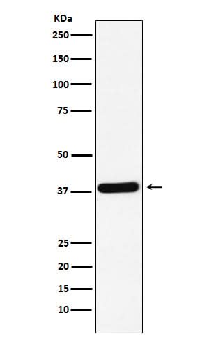 Anti-CRKII Rabbit Monoclonal Antibody Boster Bio