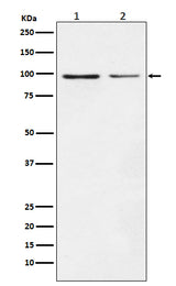 Anti-Dynamin 1 DNM1 Rabbit Monoclonal Antibody Boster Bio