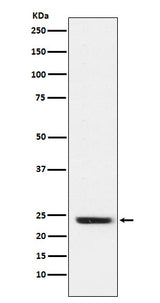 Anti-FNDC5 Rabbit Monoclonal Antibody Boster Bio