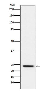Anti-FNDC5 Rabbit Monoclonal Antibody Boster Bio
