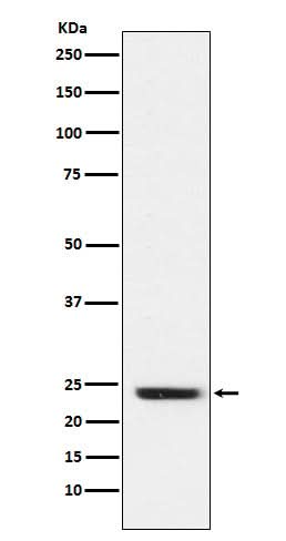 Anti-FNDC5 Rabbit Monoclonal Antibody Boster Bio