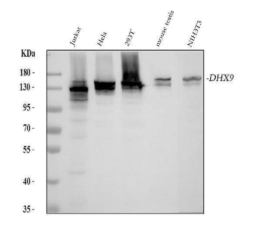 Anti-RNA Helicase A Rabbit Monoclonal Antibody Boster Bio