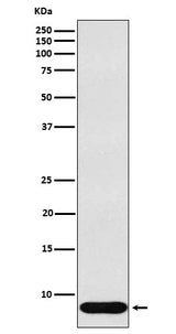Anti-beta Defensin 1 Rabbit Monoclonal Antibody Boster Bio