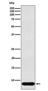 Anti-beta Defensin 1 Rabbit Monoclonal Antibody Boster Bio