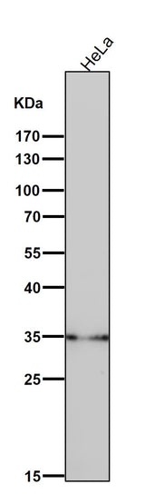 Anti-LDHB Rabbit Monoclonal Antibody Boster Bio
