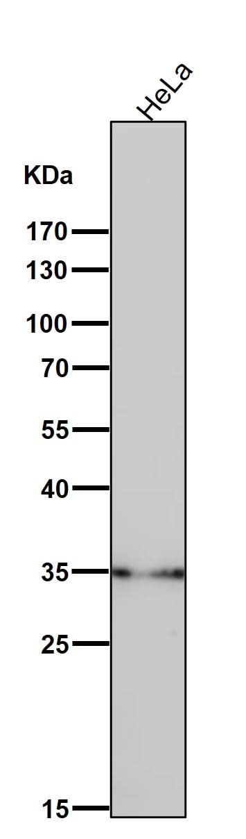 Anti-LDHB Rabbit Monoclonal Antibody Boster Bio