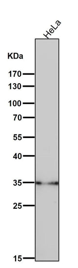 Anti-LDHB Rabbit Monoclonal Antibody Boster Bio