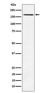 Anti-AGL Rabbit Monoclonal Antibody Boster Bio