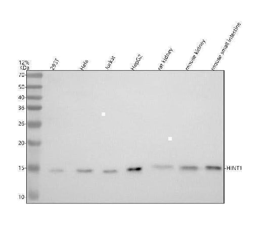 Anti-HINT1 Rabbit Monoclonal Antibody Boster Bio