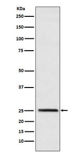 Anti-Triosephosphate isomerase Rabbit Monoclonal Antibody Boster Bio