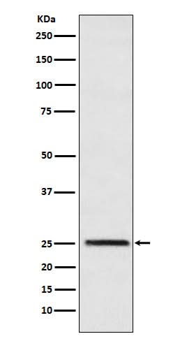 Anti-Triosephosphate isomerase Rabbit Monoclonal Antibody Boster Bio