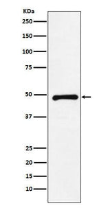 Anti-CTBP2 Rabbit Monoclonal Antibody Boster Bio