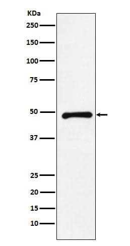 Anti-CTBP2 Rabbit Monoclonal Antibody Boster Bio