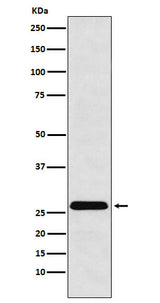 Anti-HLA-DRB4 Rabbit Monoclonal Antibody Boster Bio