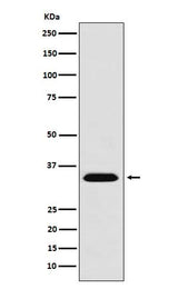 Anti-MBD3 Monoclonal Antibody Boster Bio