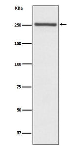 Anti-NOTCH4 Rabbit Monoclonal Antibody Boster Bio