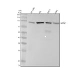 Anti-SATB2 Rabbit Monoclonal Antibody Boster Bio