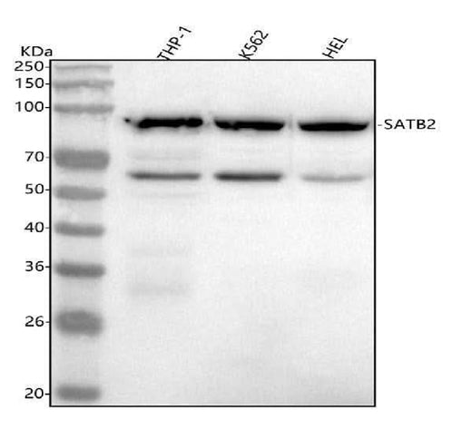 Anti-SATB2 Rabbit Monoclonal Antibody Boster Bio