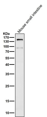 Anti-CD13 ANPEP Rabbit Monoclonal Antibody Boster Bio