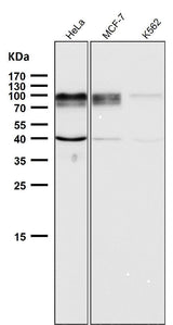 Anti-ADAM15 Rabbit Monoclonal Antibody Boster Bio