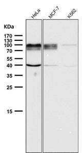 Anti-ADAM15 Rabbit Monoclonal Antibody Boster Bio