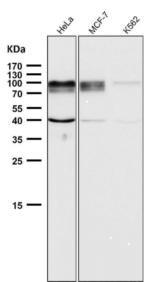 Anti-ADAM15 Rabbit Monoclonal Antibody Boster Bio