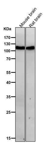 Anti-JAK3 Rabbit Monoclonal Antibody Boster Bio