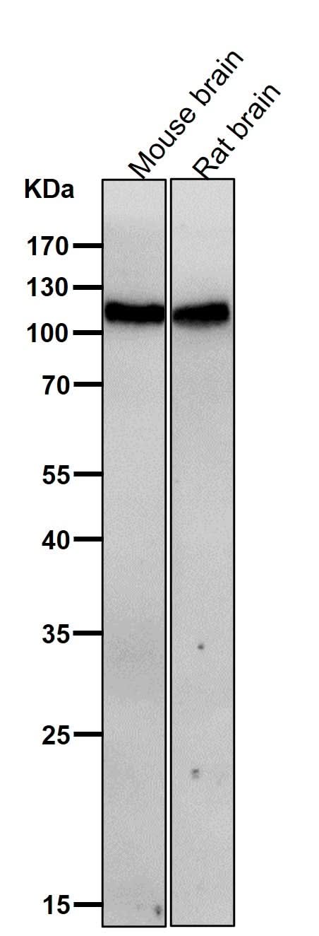 Anti-JAK3 Rabbit Monoclonal Antibody Boster Bio
