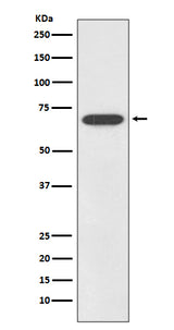 Anti-SOX11 Rabbit Monoclonal Antibody Boster Bio