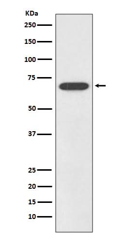 Anti-SOX11 Rabbit Monoclonal Antibody Boster Bio