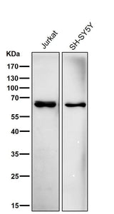Anti-ACADVL/VLCAD Rabbit Monoclonal Antibody Boster Bio