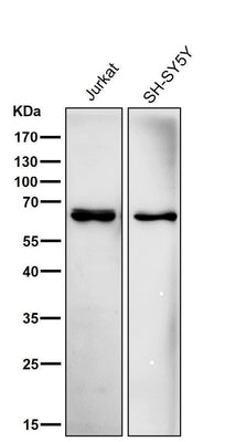 Anti-ACADVL/VLCAD Rabbit Monoclonal Antibody Boster Bio